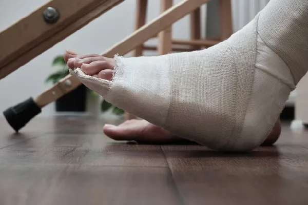 Fractures